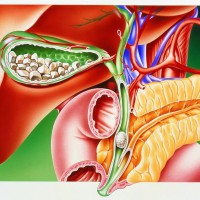 Заброс желчи в желудок – причины и лечение