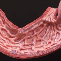 Лимфофолликулярная гиперплазия нижней части желудка