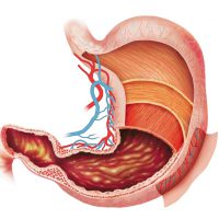 Препилорический отдел желудка: месторасположение, заболевания