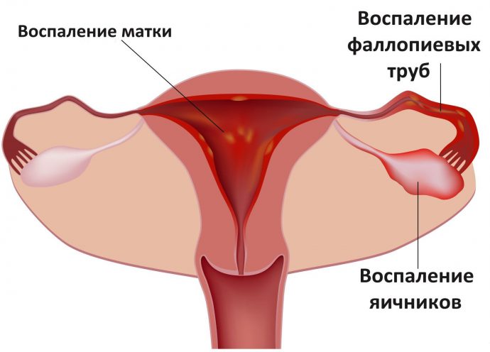 патологии женских органов