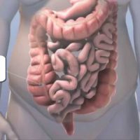 Болезни толстой кишки: симптомы и лечение